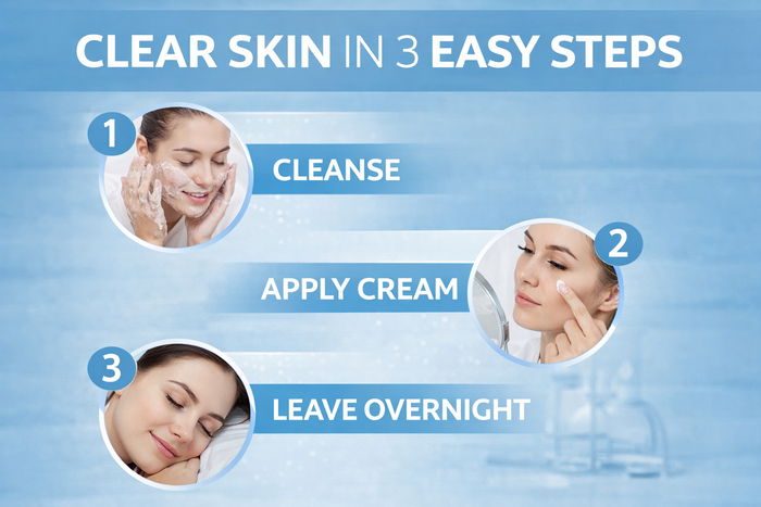 Chear Acne Target Cream 50ml – Salicylic Acid Spot Treatment with Aloe Vera, Tea Tree & Neem | Clear Skin Fast