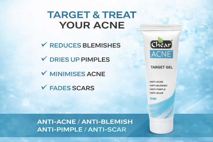 Chear Acne Target Gel 50ml | Salicylic Acid Spot Treatment with Aloe Vera, Neem & Lemon | Fast-Acting Acne & Blemish Gel UK