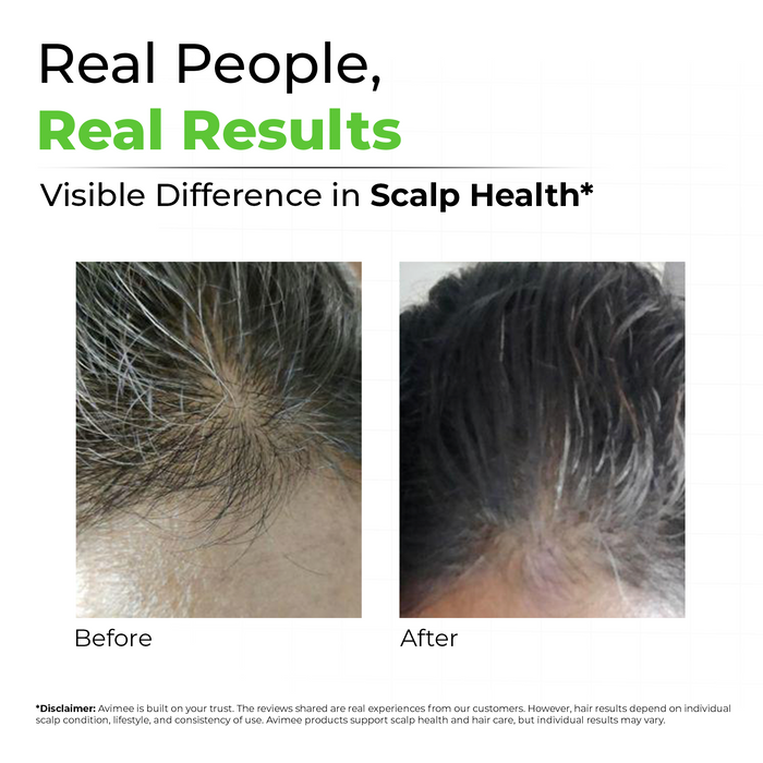 Keshkrishna Grey Hair Oil