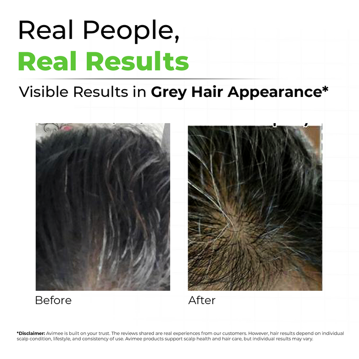 Scalptone Grey Hair Serum